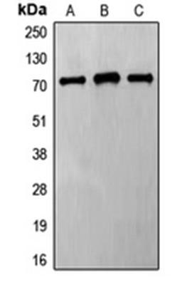 Western blot analysis of HeLa (Lane 1), Jurkat (Lane 2), MCF7 (Lane 3) whole cell lysates using FZD8 antibody