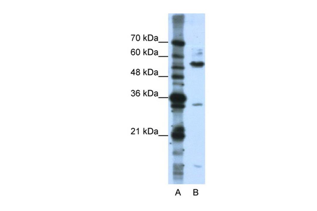 Antibody used in WB on Human Jurkat 0.2-1 ug/ml.