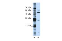 Antibody used in WB on Human Jurkat 0.2-1 ug/ml.