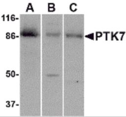 Western blot analysis of PTK7 in (A) human colon, (B) mouse kidney and (C) rat liver tissue lysate with PTK7 antibody at 1 &#956;g/mL.