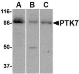 Western blot analysis of PTK7 in (A) human colon, (B) mouse kidney and (C) rat liver tissue lysate with PTK7 antibody at 1 μg/mL.