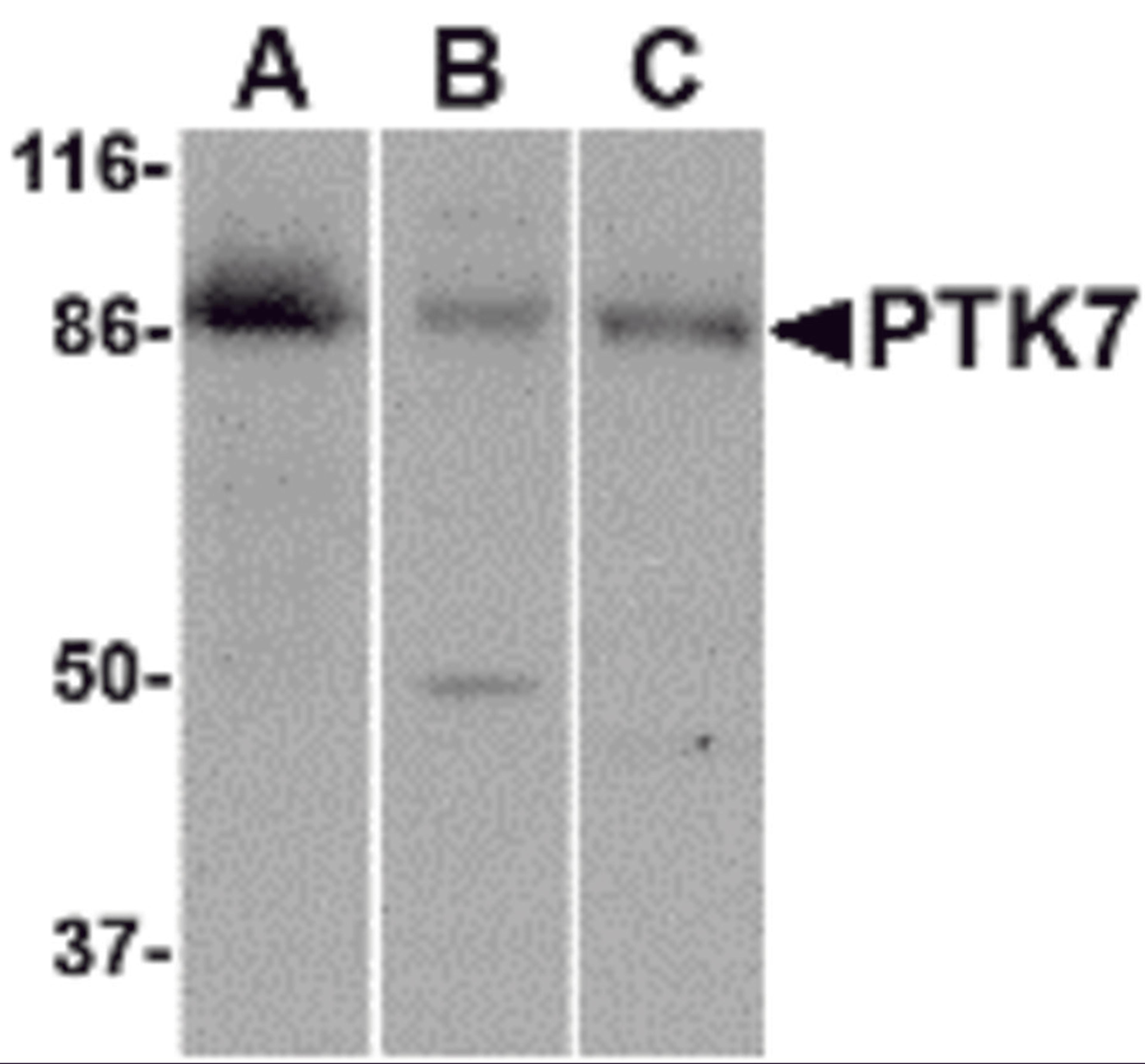 Western blot analysis of PTK7 in (A) human colon, (B) mouse kidney and (C) rat liver tissue lysate with PTK7 antibody at 1 μg/mL.