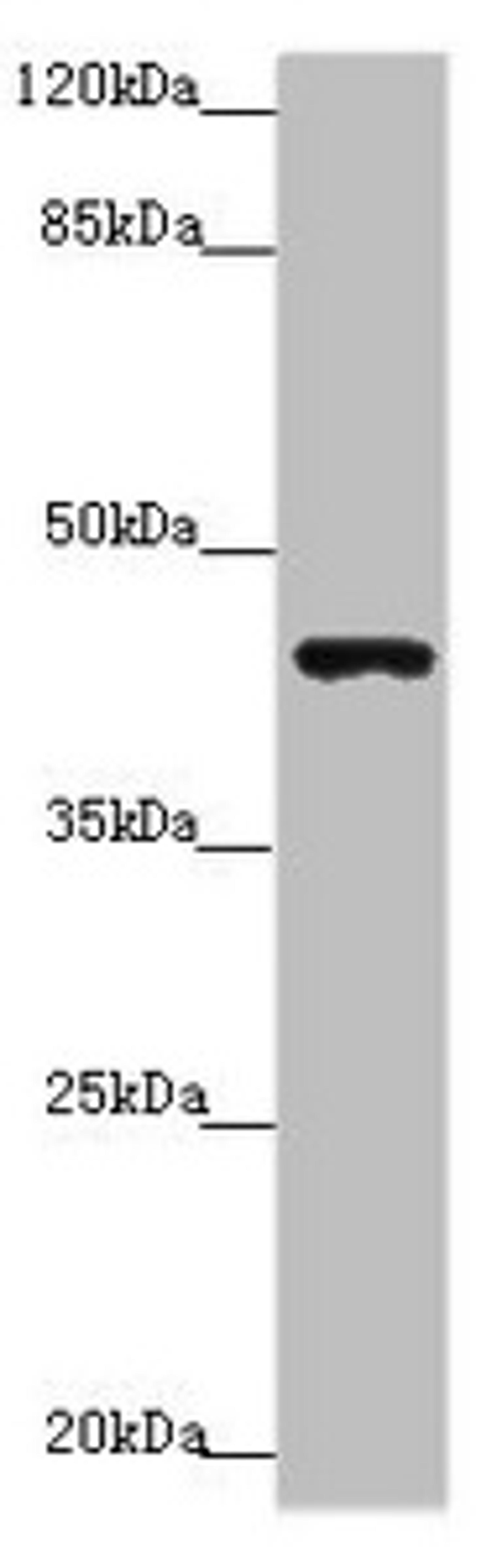 Western blot. All lanes: P2RX3 antibody at 3.91 ug/ml + Mouse liver tissue. Secondary. Goat polyclonal to rabbit IgG at 1/10000 dilution. Predicted band size: 44 kDa. Observed band size: 44 kDa. 