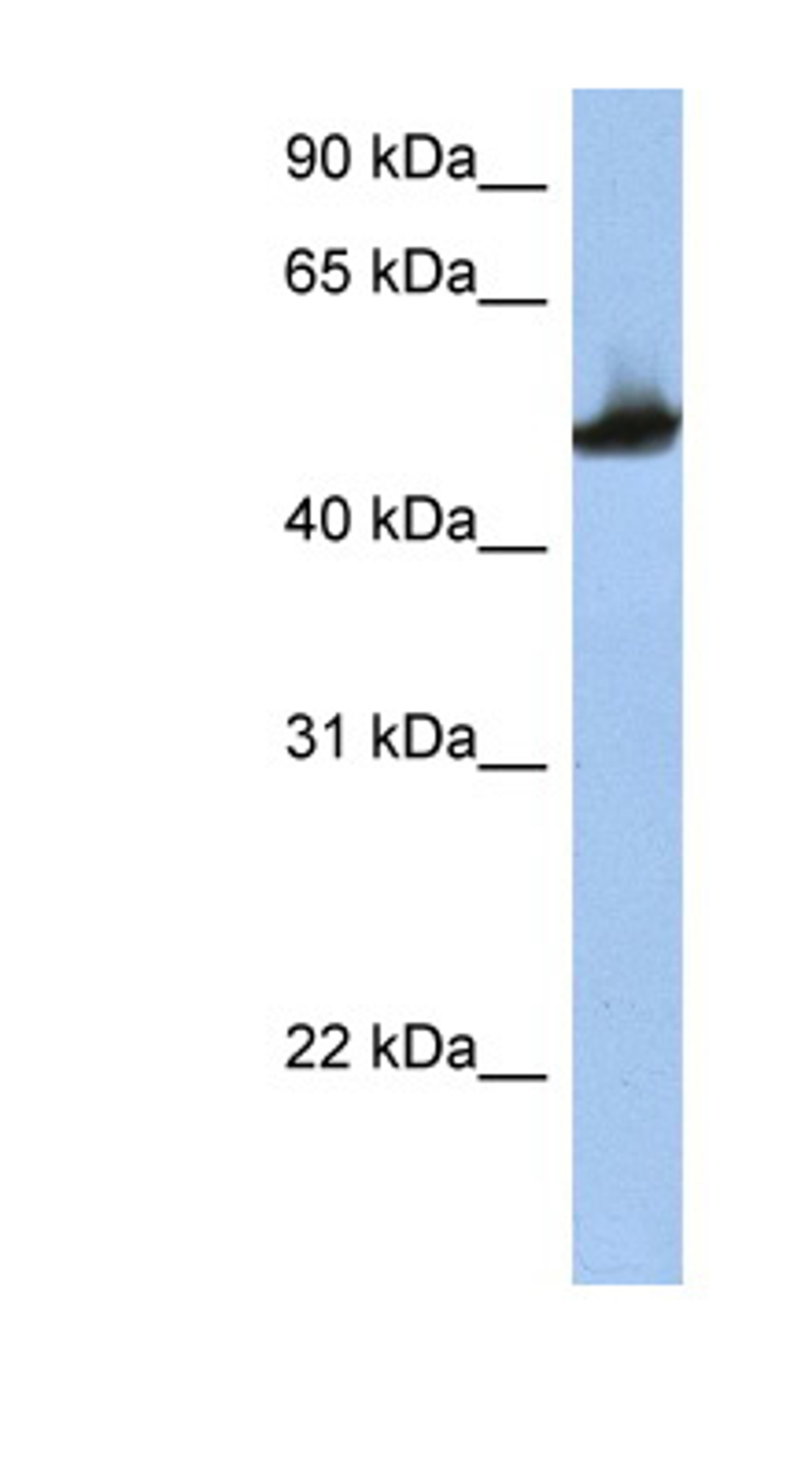 Antibody used in WB on Human HepG2 at 1 ug/ml.