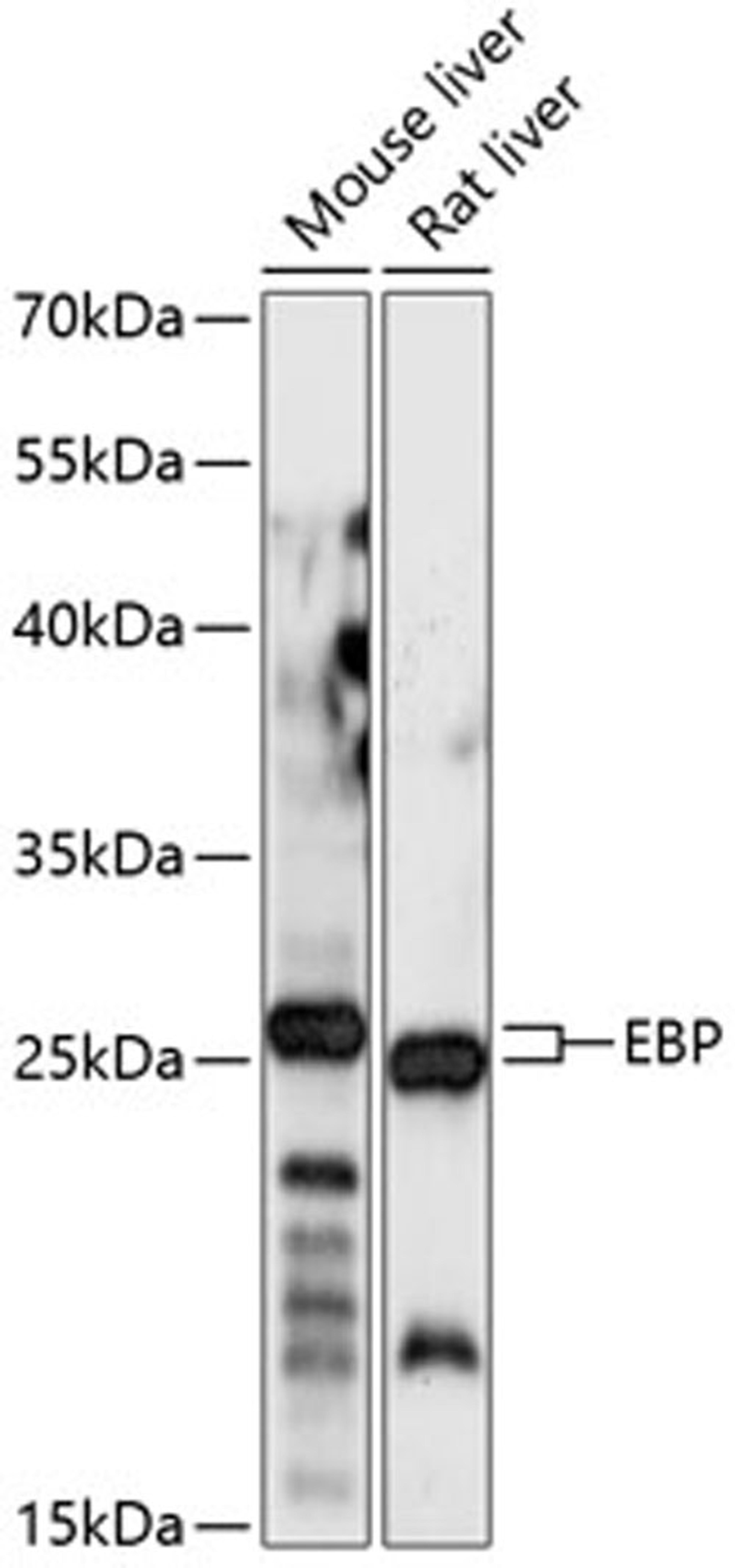 Western blot - EBP antibody (A14845)