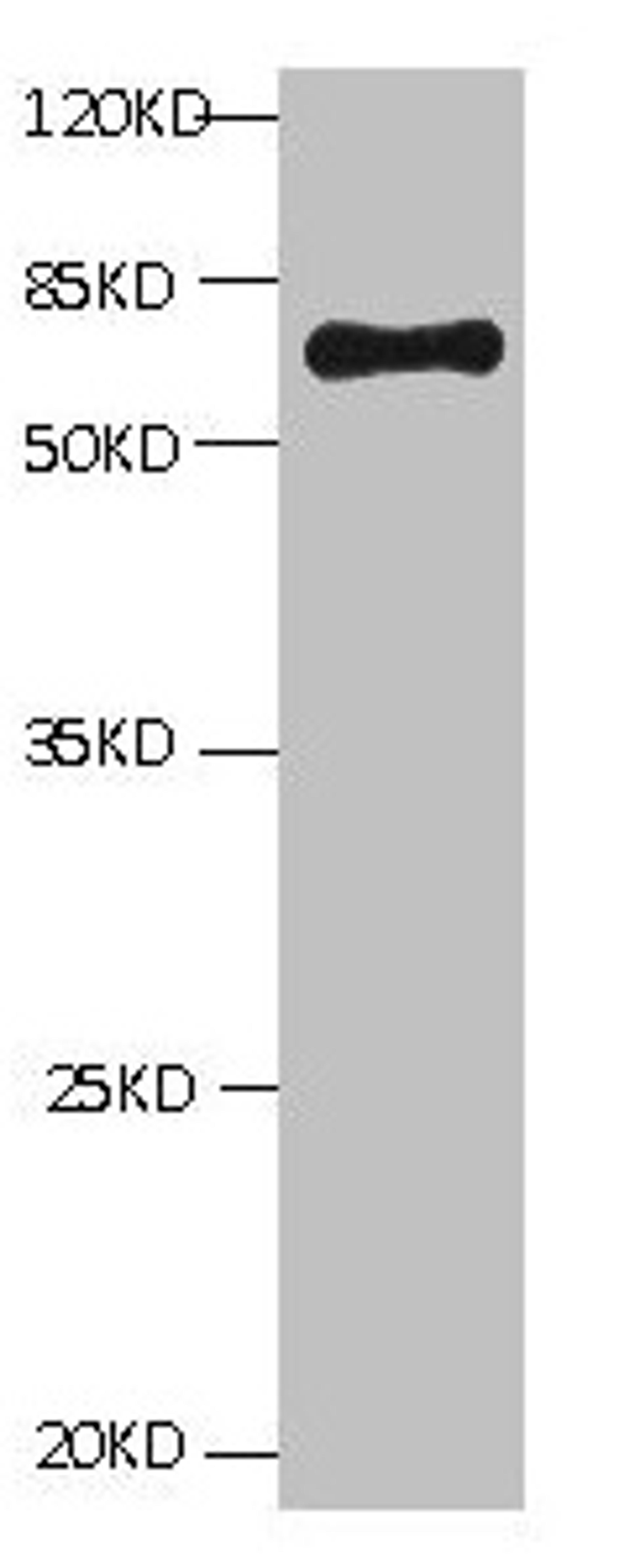All lanes: Mouse Anti-BSA monoclonal antibody at 1ug/ml. Lane 1:Bovine serum Albumin. Predicted band size : 67kd. Observed band size : 67kd.