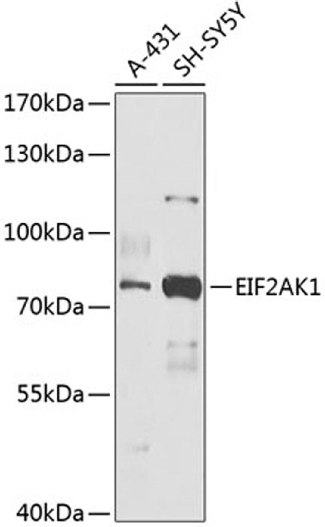 Western blot - EIF2AK1 antibody (A14119)