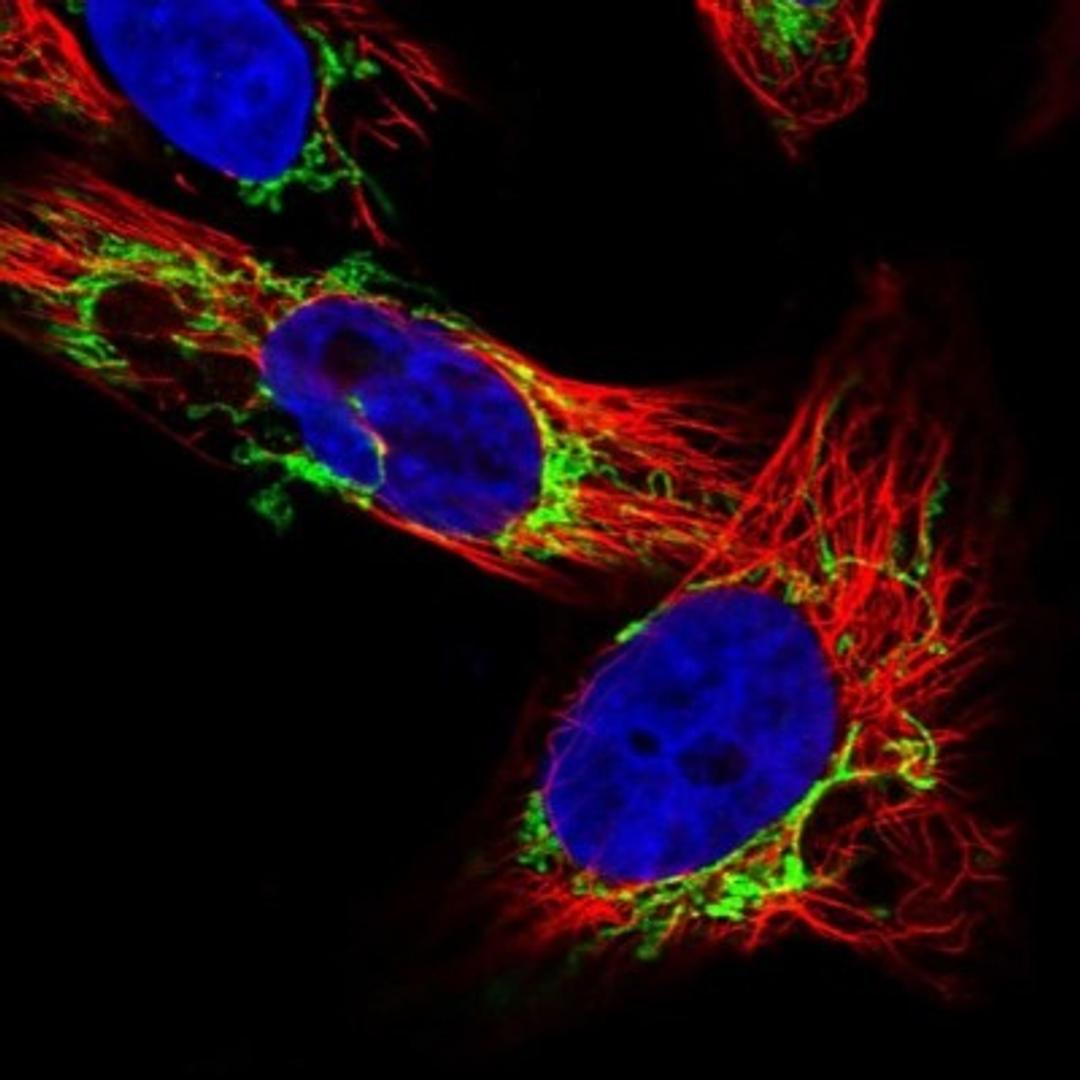 Immunocytochemistry/Immunofluorescence: OCIAD2 Antibody [NBP1-82682] - Staining of human cell line U-251 MG shows positivity in mitochondria.