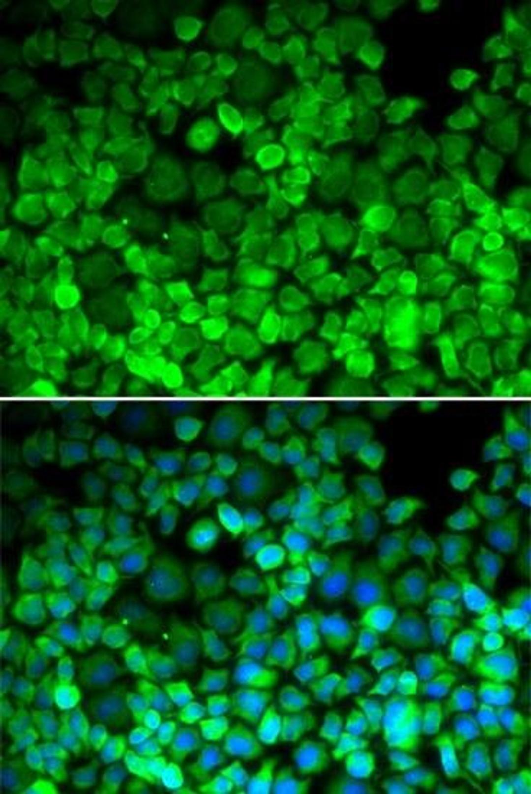 Immunofluorescence analysis of HeLa cell using TERF1 antibody