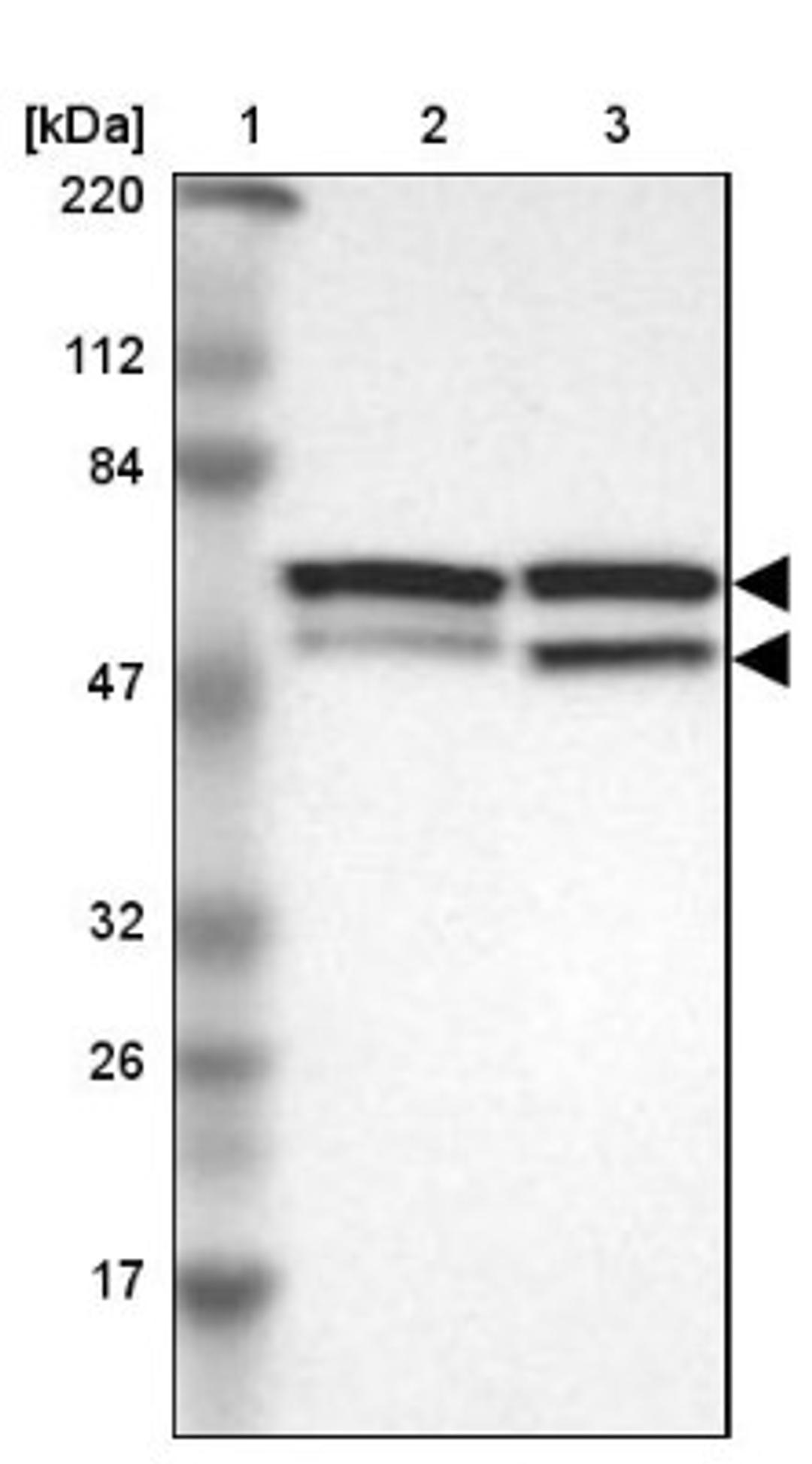 Western Blot: CDCA7 Antibody [NBP1-82224] - Lane 1: Marker [kDa] 220, 112, 84, 47, 32, 26, 17<br/>Lane 2: Human cell line RT-4<br/>Lane 3: Human cell line U-251MG sp