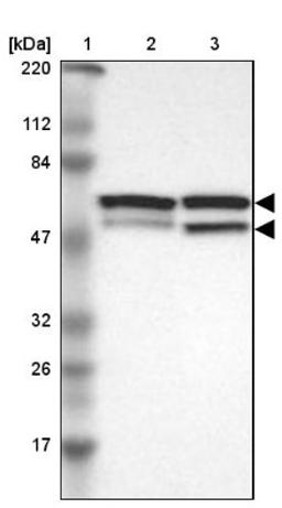 Western Blot: CDCA7 Antibody [NBP1-82224] - Lane 1: Marker [kDa] 220, 112, 84, 47, 32, 26, 17<br/>Lane 2: Human cell line RT-4<br/>Lane 3: Human cell line U-251MG sp