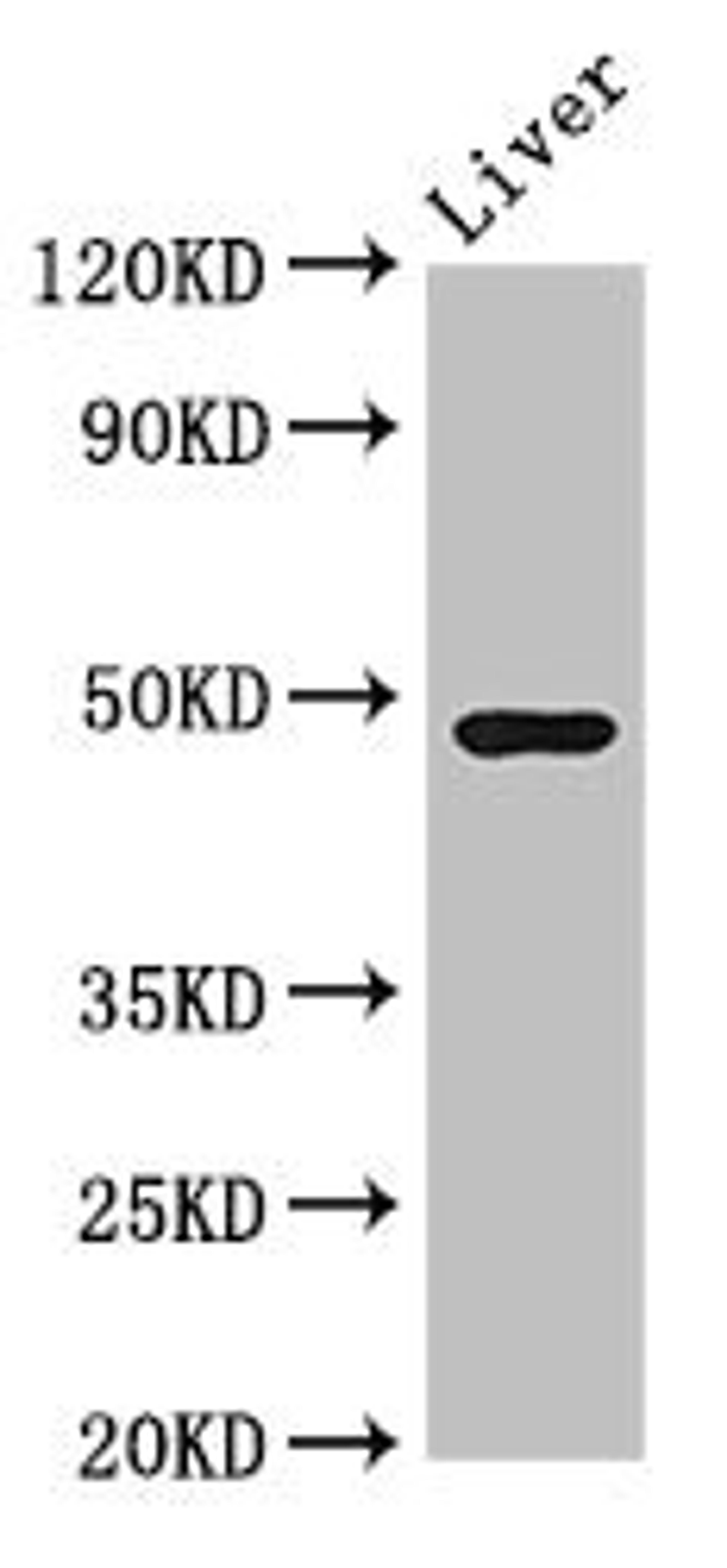 Western Blot. Positive WB detected in: Mouse liver tissue. All lanes: CPB2 antibody at 3.4ug/ml. Secondary. Goat polyclonal to rabbit IgG at 1/50000 dilution. Predicted band size: 49, 41 kDa. Observed band size: 49 kDa. 