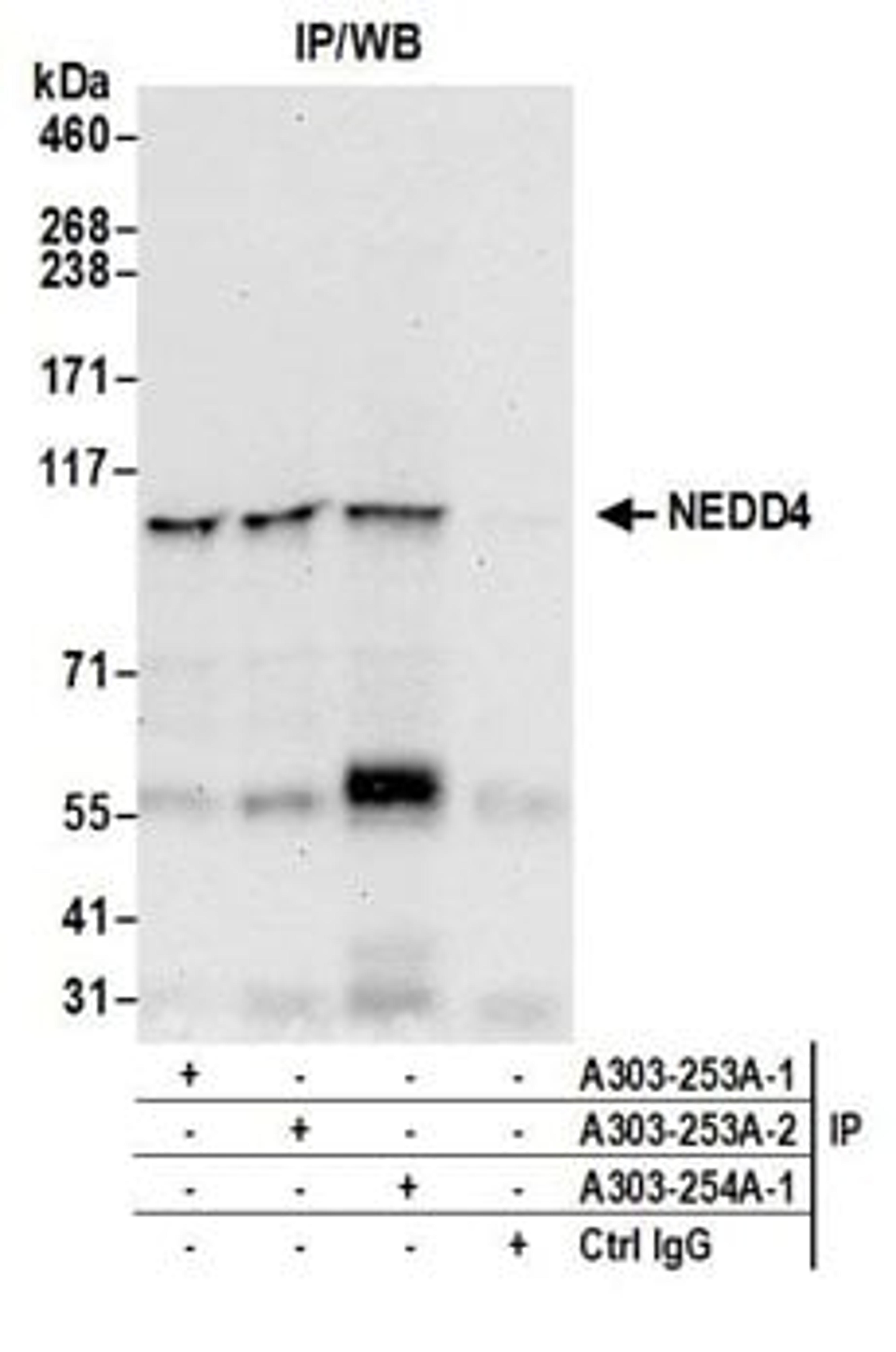 Detection of human NEDD4 by western blot of immunoprecipitates.