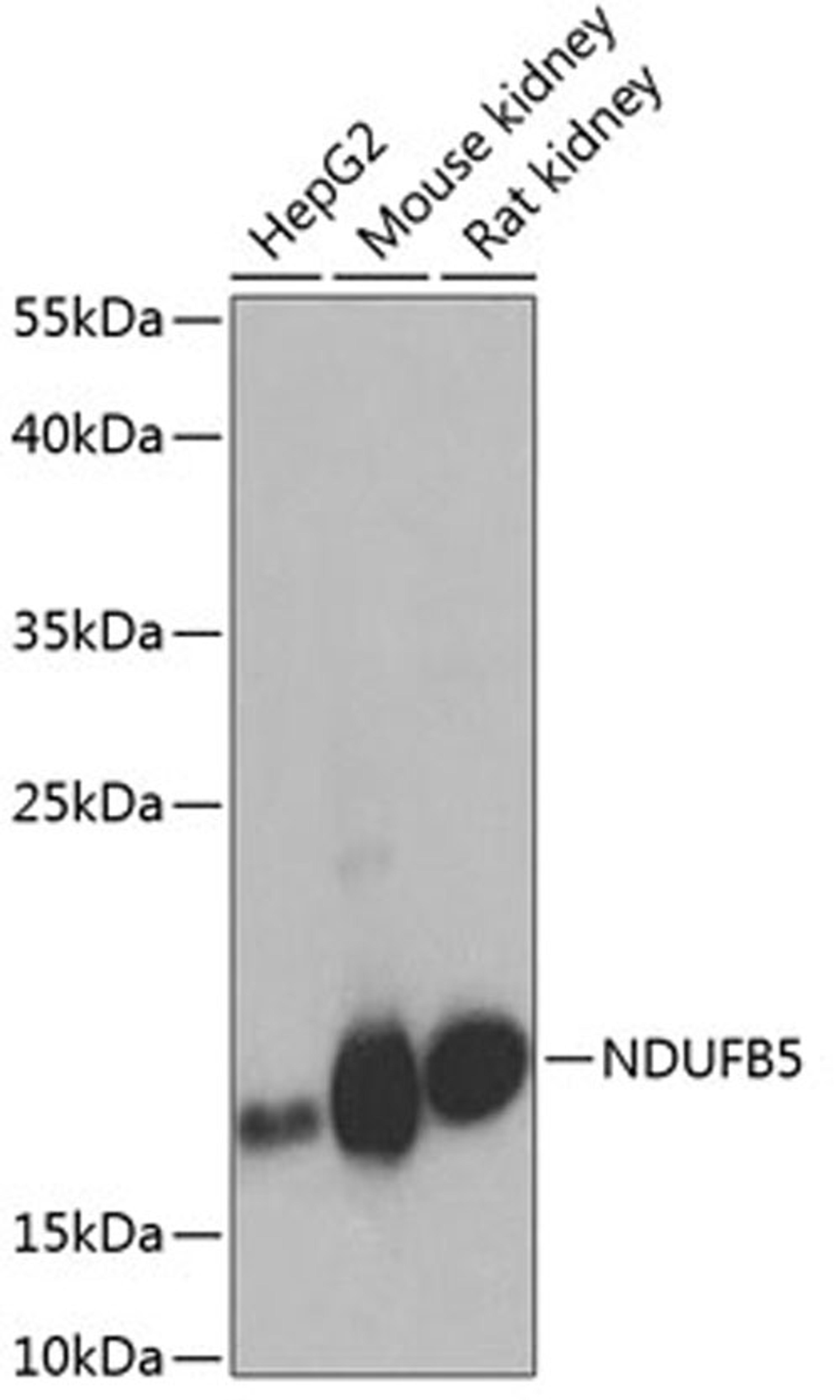 Western blot - NDUFB5 antibody (A8327)