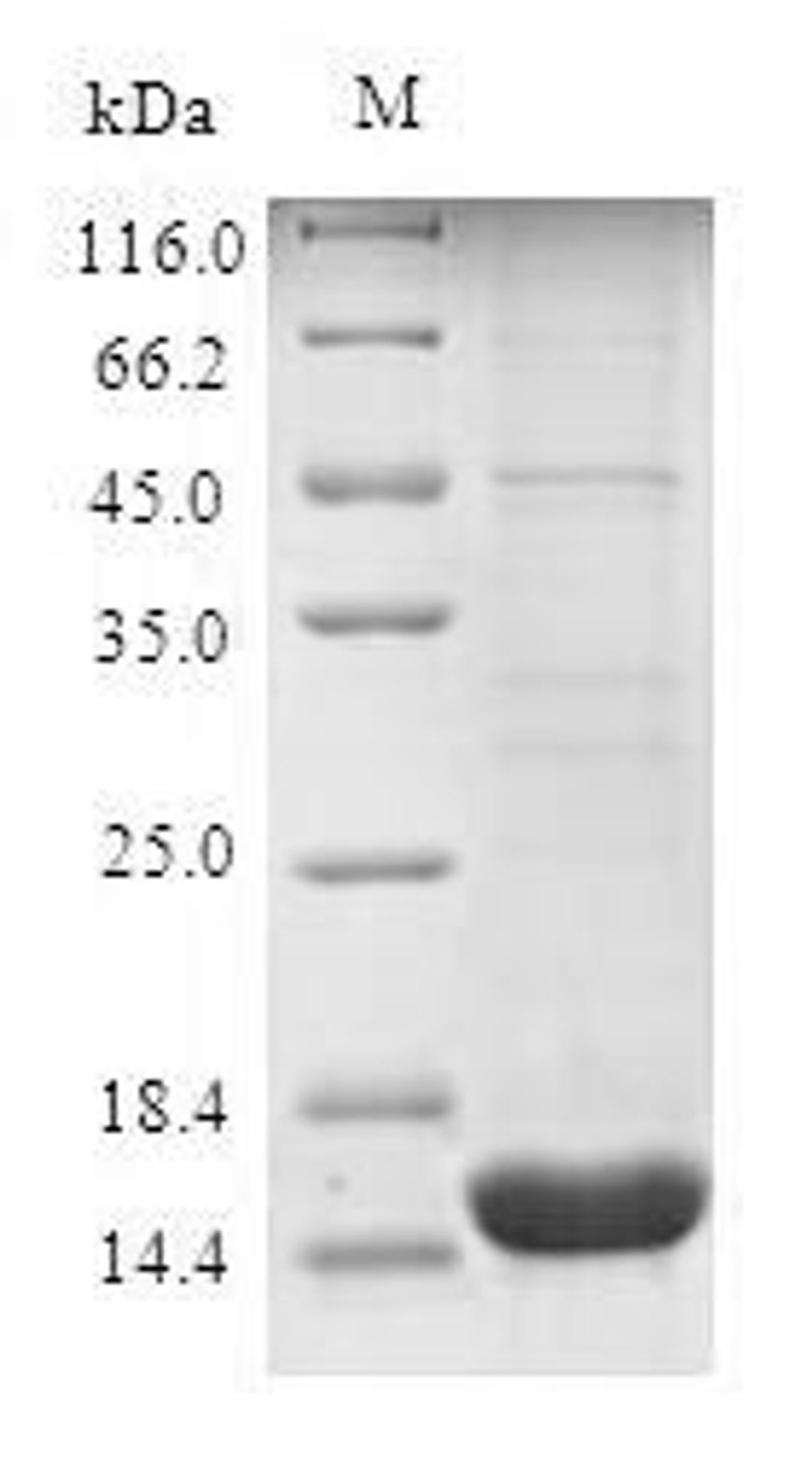 (Tris-Glycine gel) Discontinuous SDS-PAGE (reduced) with 5% enrichment gel and 15% separation gel.