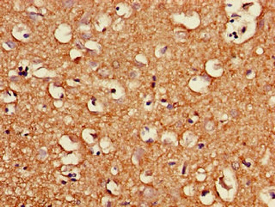 Immunohistochemistry of paraffin-embedded human brain tissue using CSB-PA844728LA01HU at dilution of 1:100
