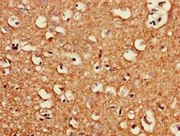 Immunohistochemistry of paraffin-embedded human brain tissue using CSB-PA844728LA01HU at dilution of 1:100