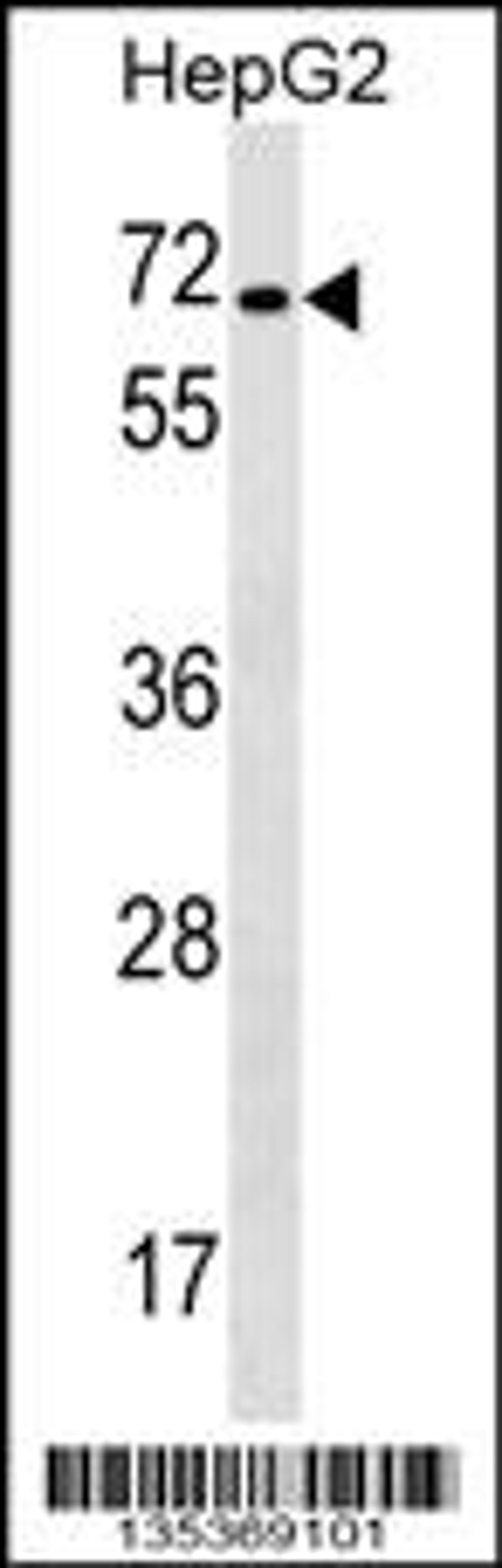 Western blot analysis in HepG2 cell line lysates (35ug/lane).