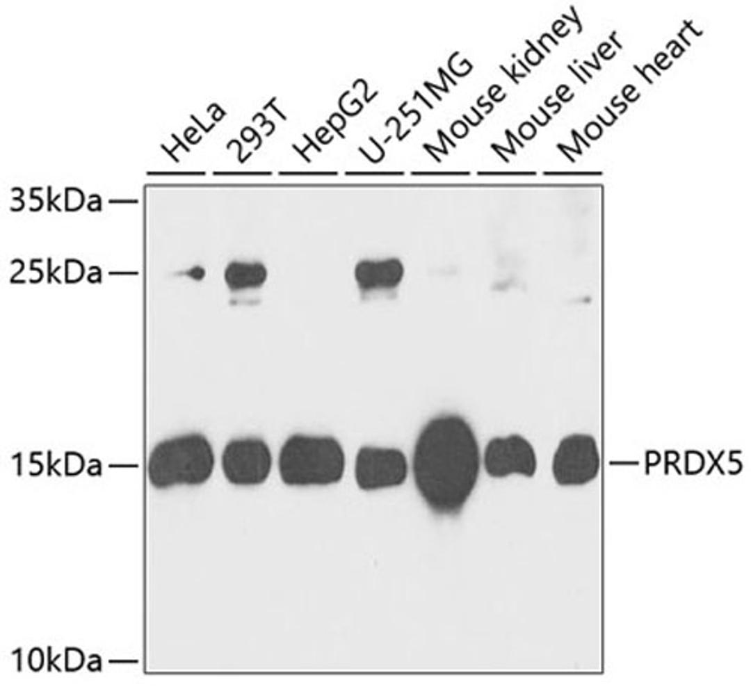 Western blot - PRDX5 antibody (A6329)