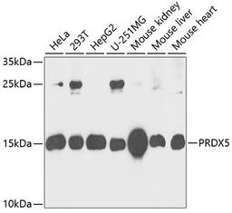 Western blot - PRDX5 antibody (A6329)