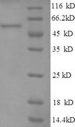 (Tris-Glycine gel) Discontinuous SDS-PAGE (reduced) with 5% enrichment gel and 15% separation gel.