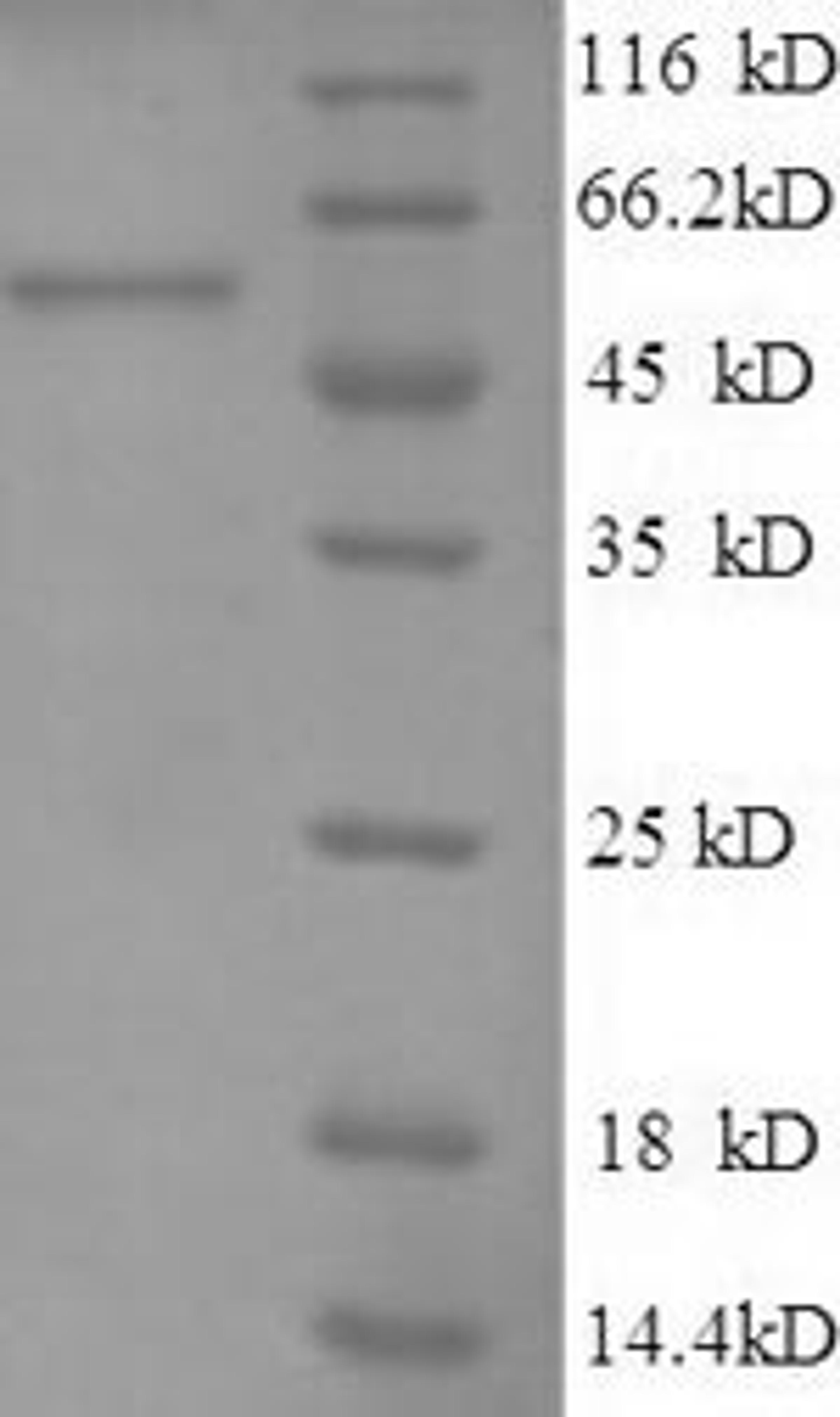 (Tris-Glycine gel) Discontinuous SDS-PAGE (reduced) with 5% enrichment gel and 15% separation gel.