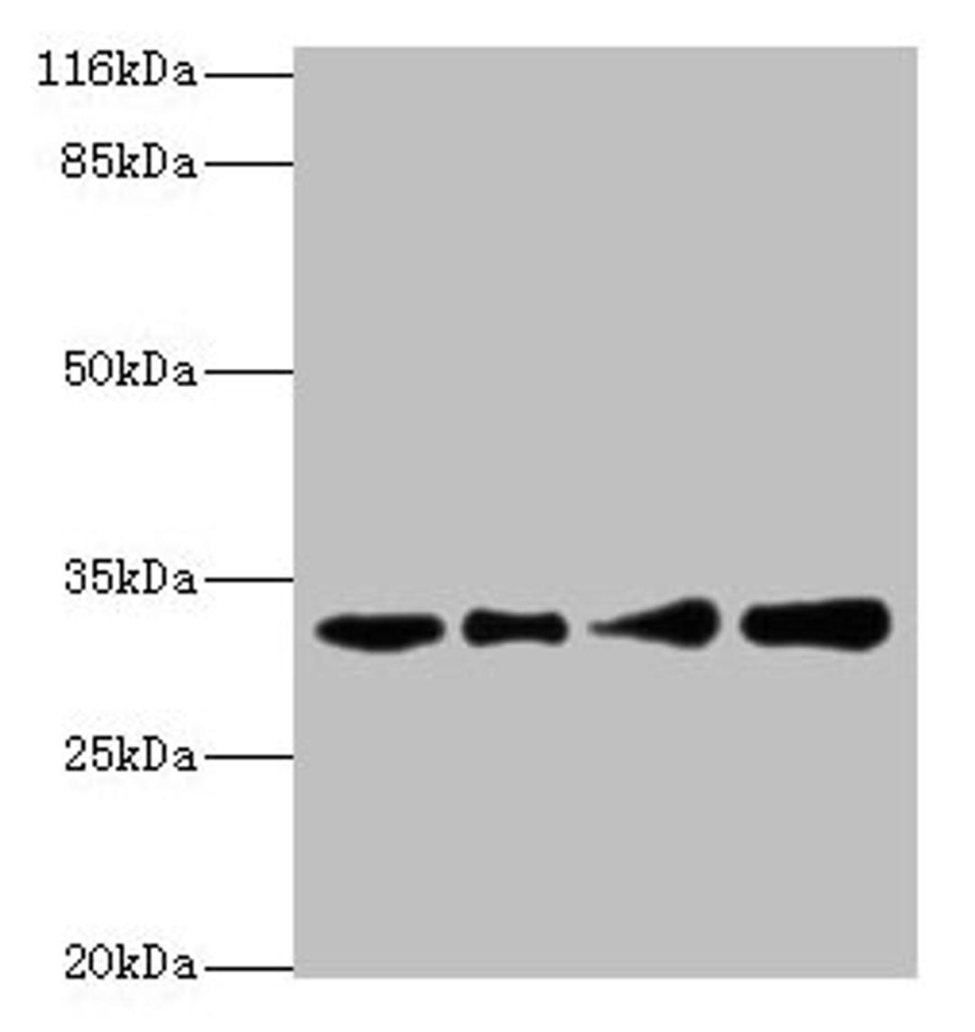 Western blot. All lanes: RSU1 antibody at 2µg/ml. Lane 1: Human placenta tissue. Lane 2: Caco-2 whole cell lysate. Lane 3: Jurkat whole cell lysate. Lane 4: HepG2 whole cell lysate. Secondary. Goat polyclonal to rabbit IgG at 1/10000 dilution. Predicted band size: 32, 26 kDa. Observed band size: 32 kDa