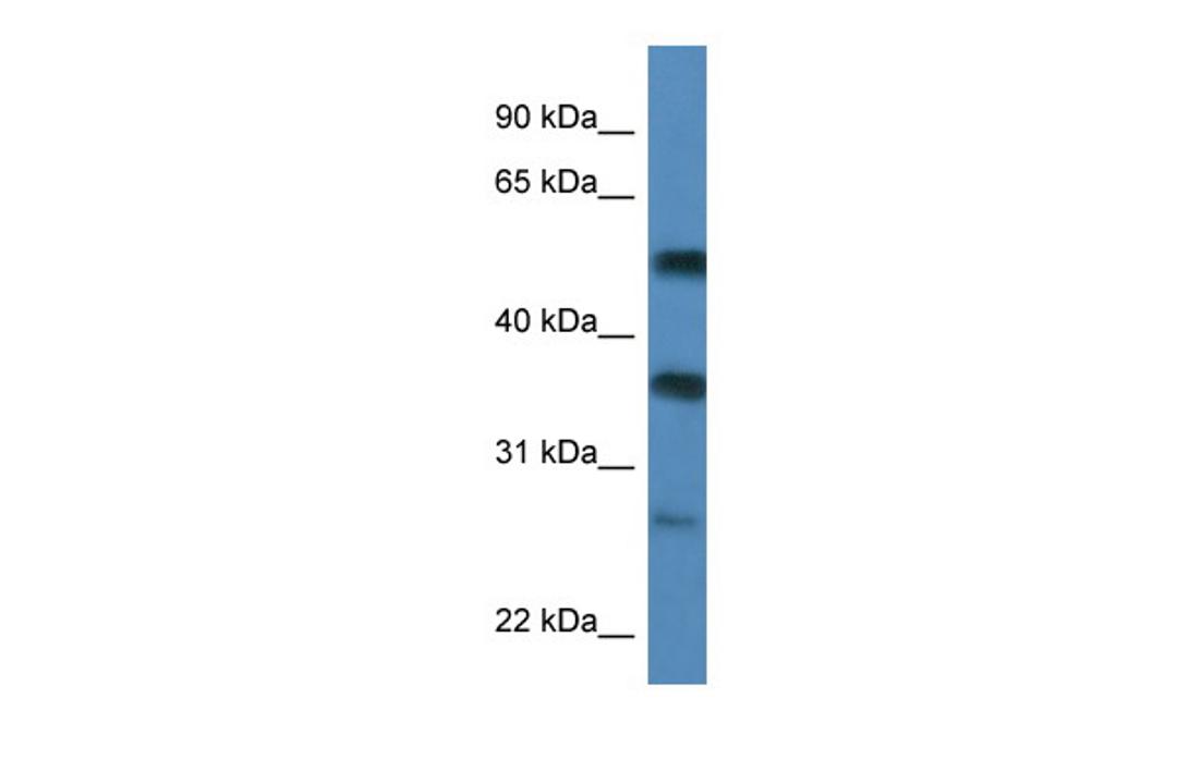 Antibody used in WB on Human MCF-7 at 0.2-1 ug/ml.