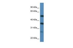 Antibody used in WB on Human MCF-7 at 0.2-1 ug/ml.