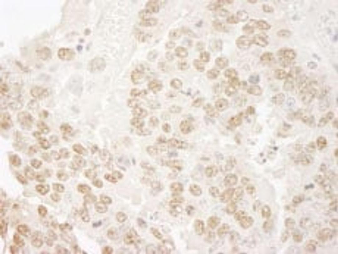 Detection of mouse hPrp3p immunohistochemistry.