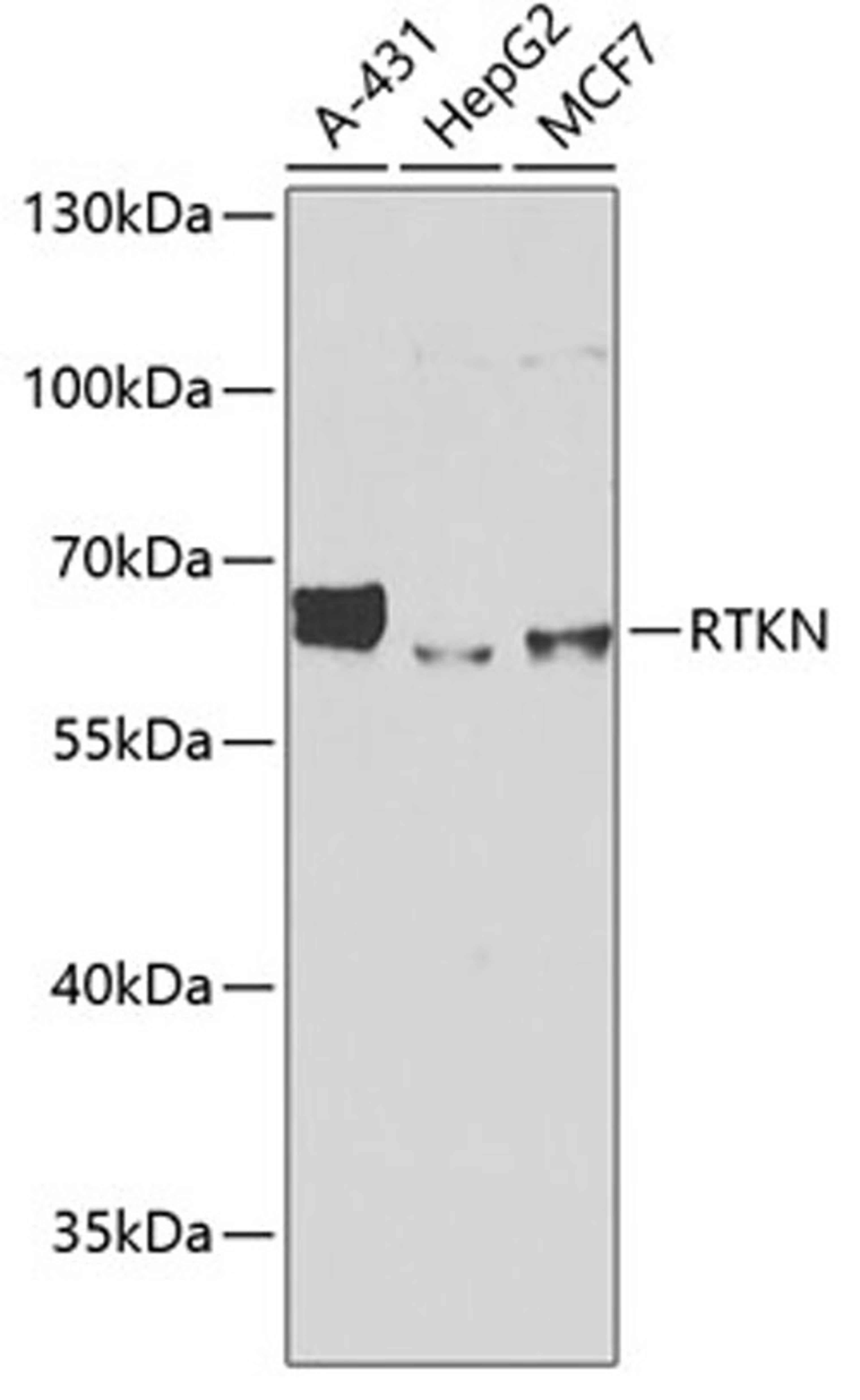 Western blot - RTKN antibody (A6732)