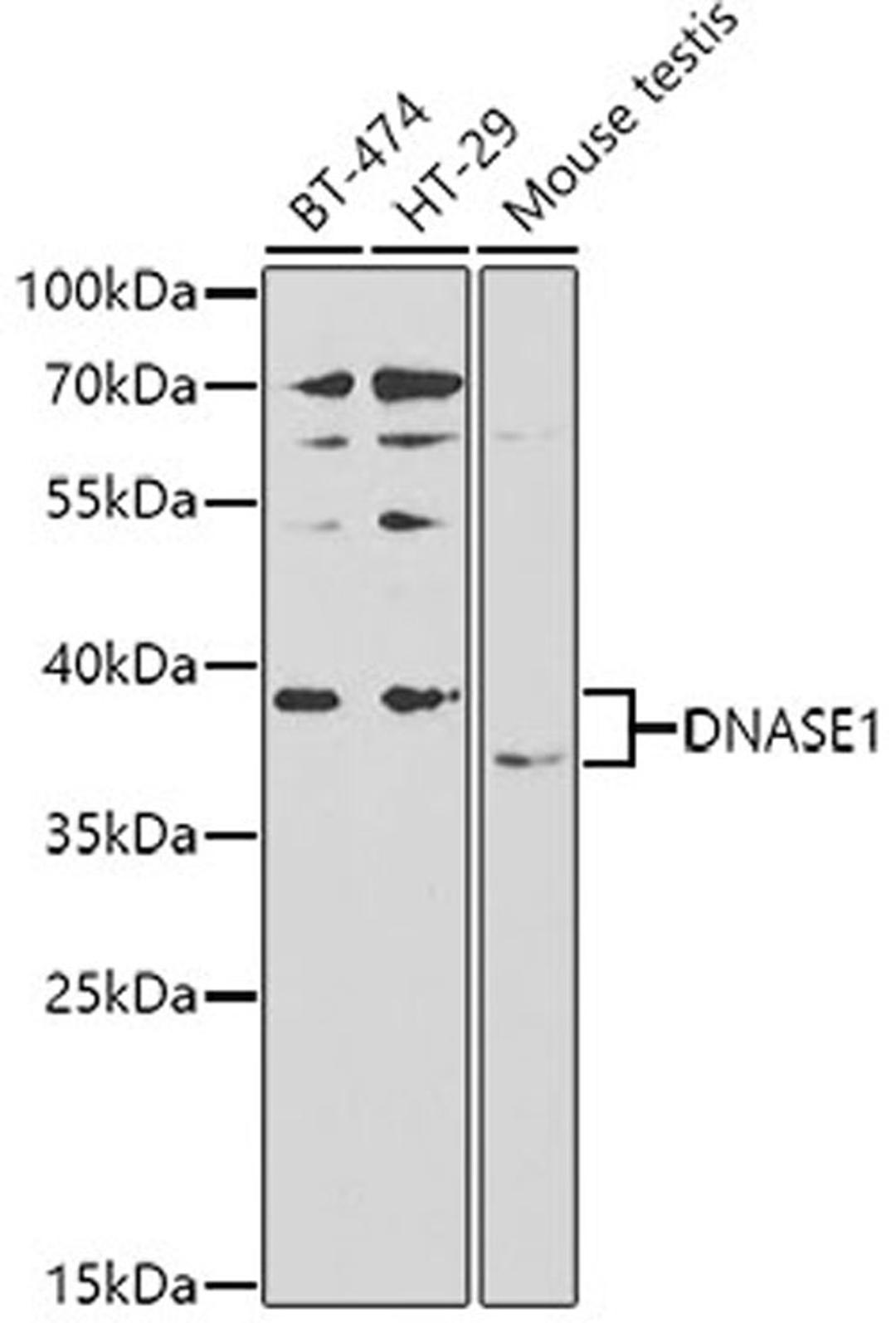 Western blot - DNASE1 antibody (A2537)