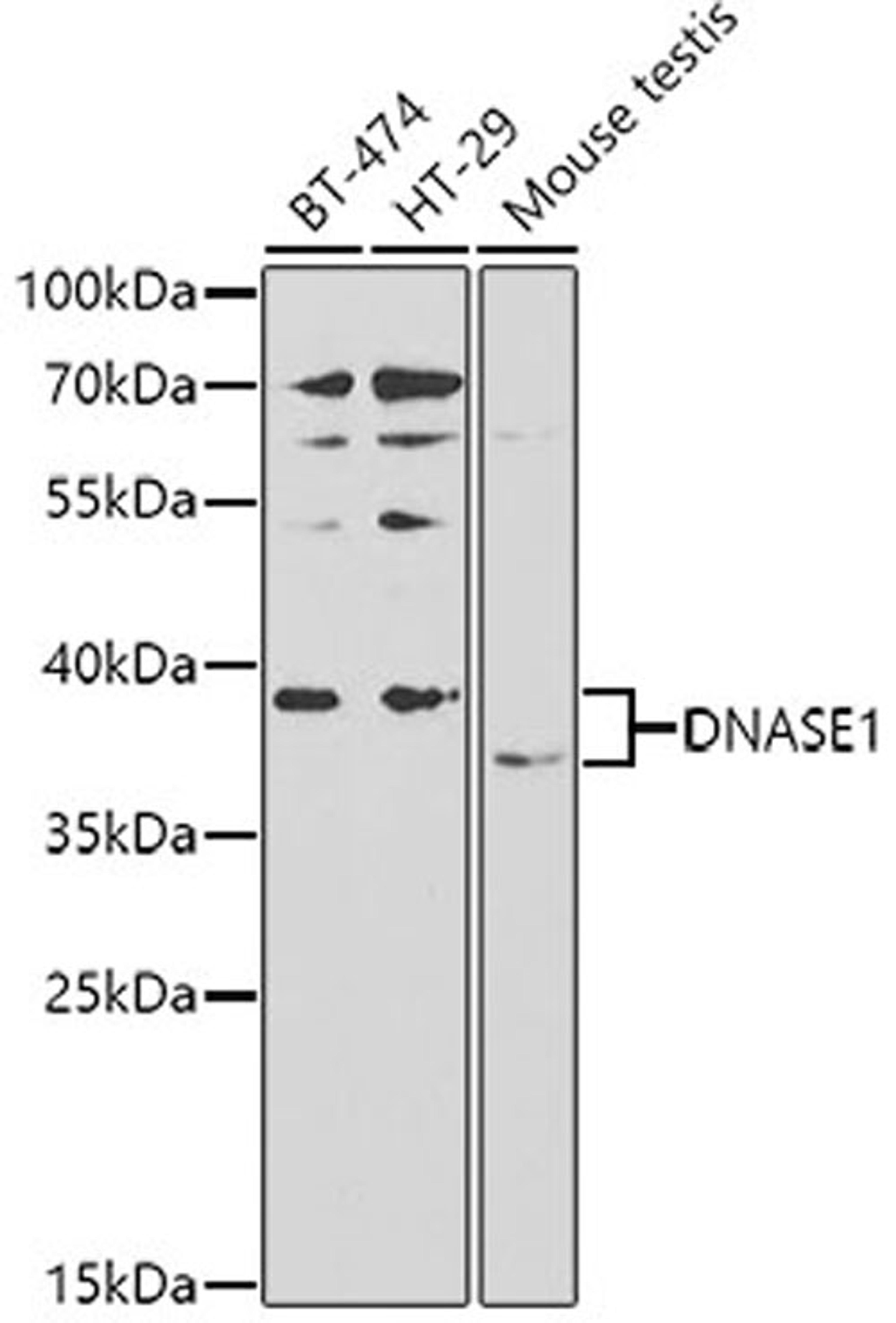 Western blot - DNASE1 antibody (A2537)