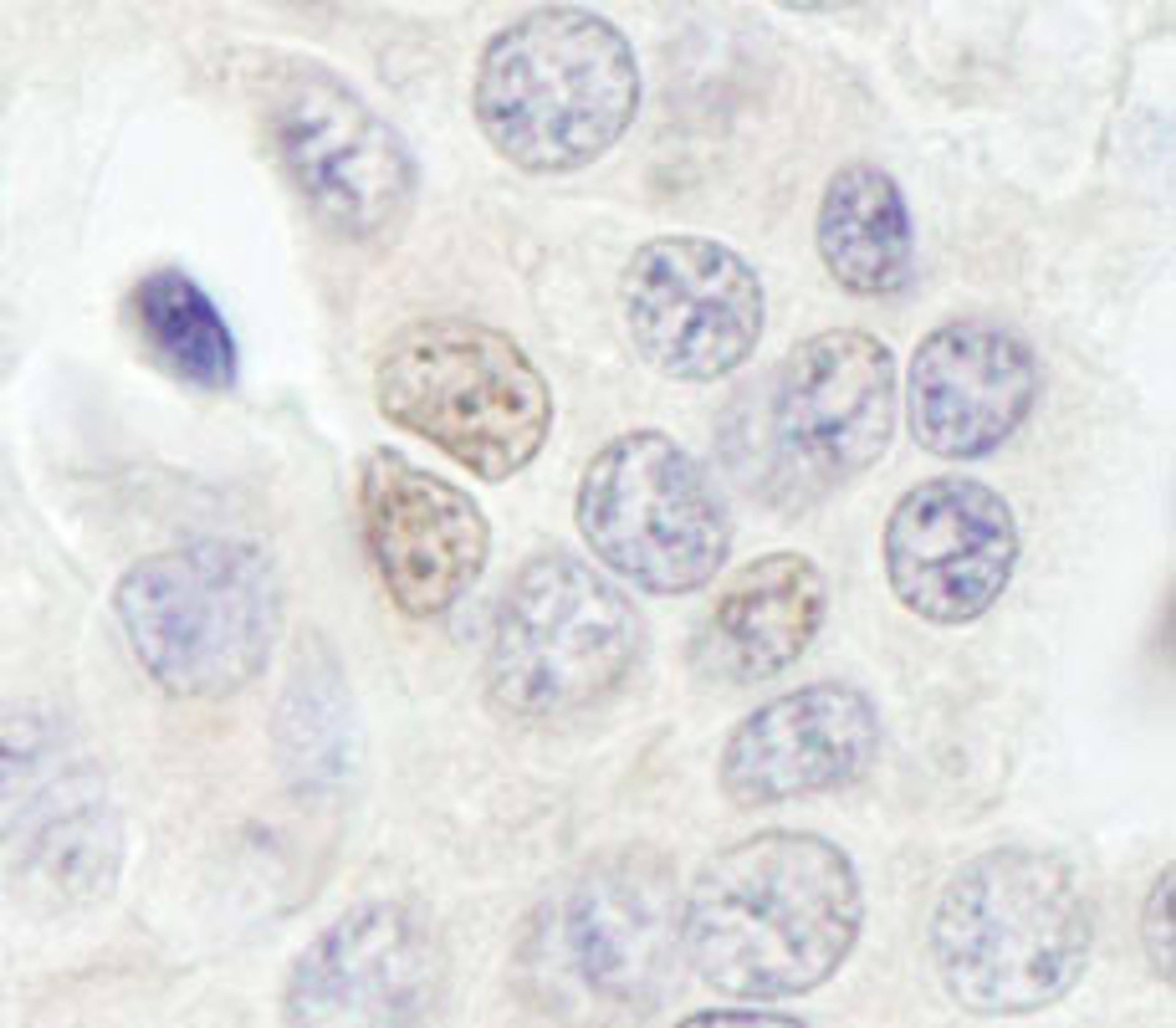 Detection of human RBM27 by immunohistochemistry.