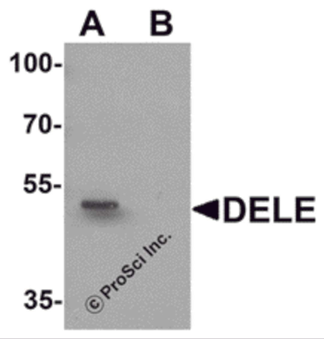 Western blot analysis of DELE in rat brain tissue lysate with DELE antibody at 1 μg/ml in (A) the absence and (B) the presence of blocking peptide.