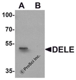 Western blot analysis of DELE in rat brain tissue lysate with DELE antibody at 1 μg/ml in (A) the absence and (B) the presence of blocking peptide.
