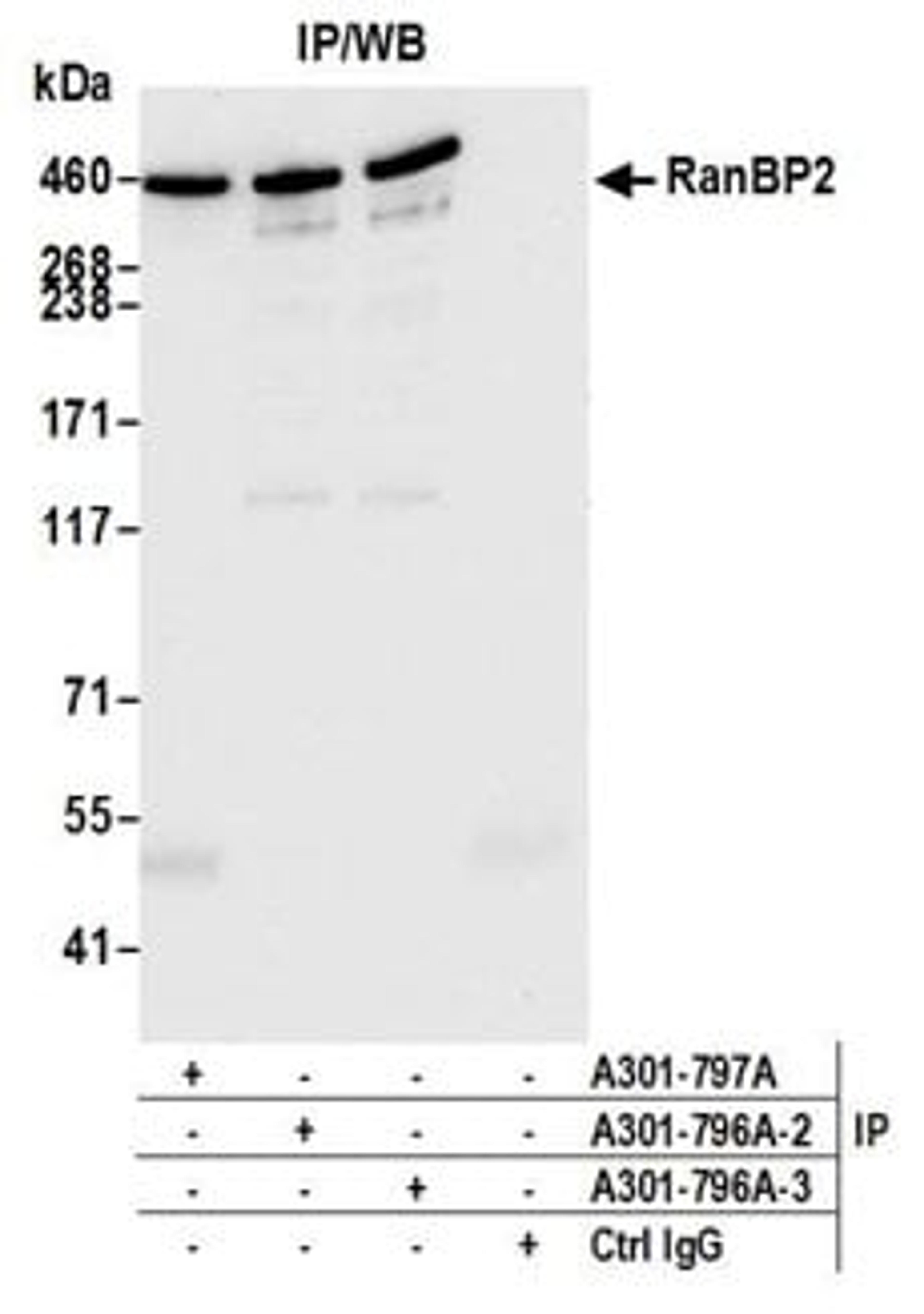 Detection of human RanBP2 by western blot of immunoprecipitates.