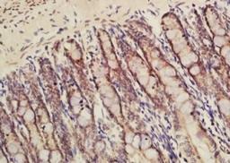 Immunohistochemical analysis of formalin-fixed paraffin embedded rat colon tissue using MTMR5 antibody (dilution at 1:200)