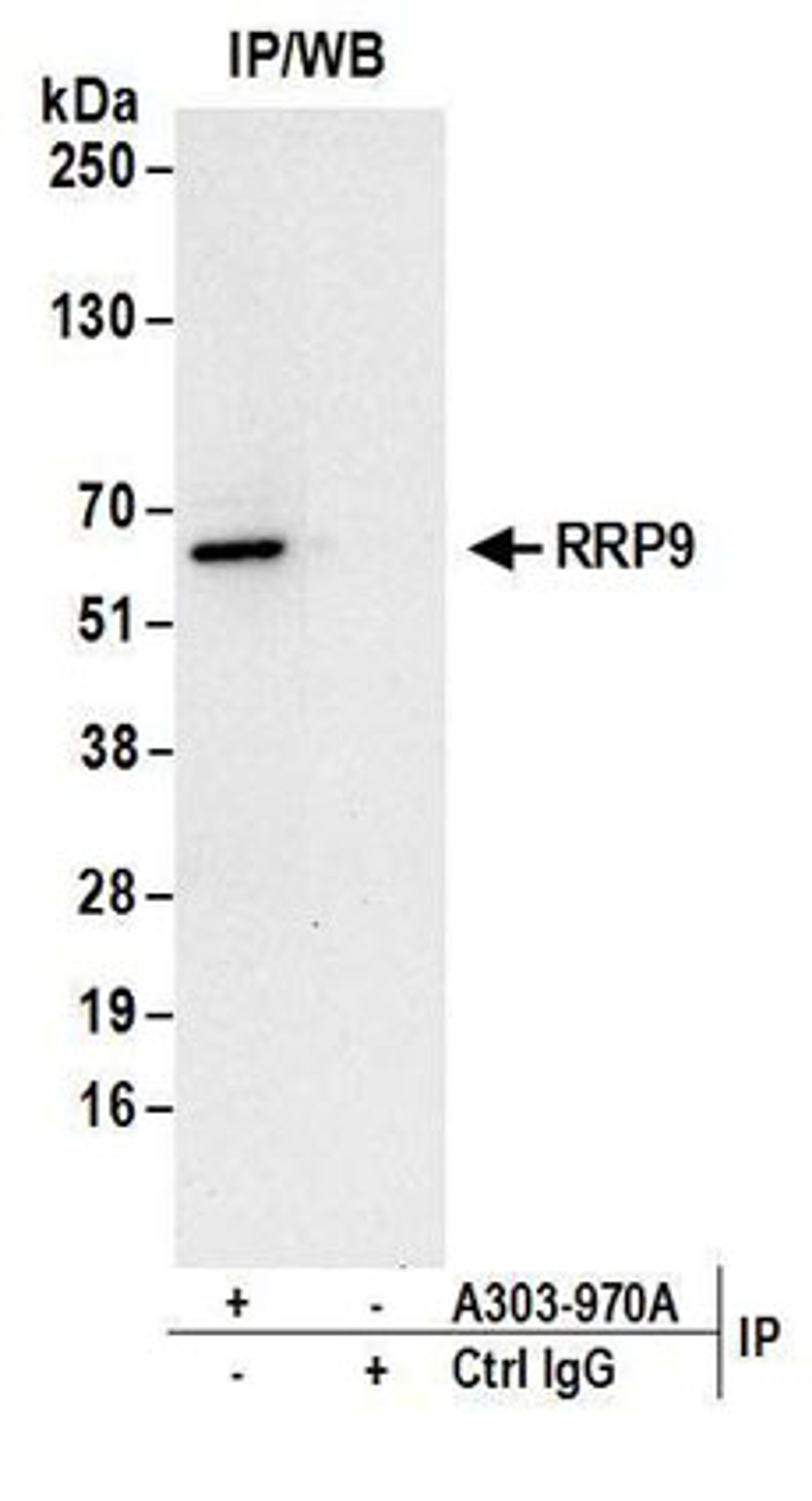 Detection of human RRP9 by western blot of immunoprecipitates.