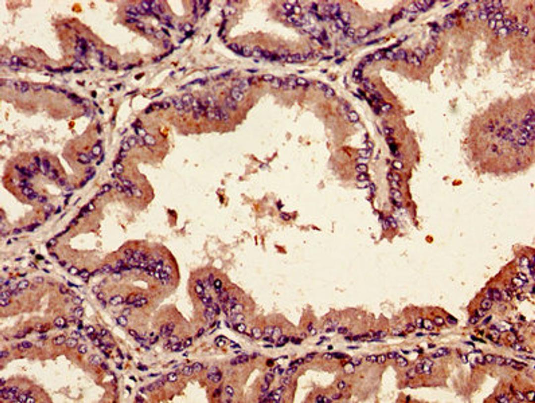 Immunohistochemistry of paraffin-embedded human prostate tissue using CSB-PA09419A0Rb at dilution of 1:100