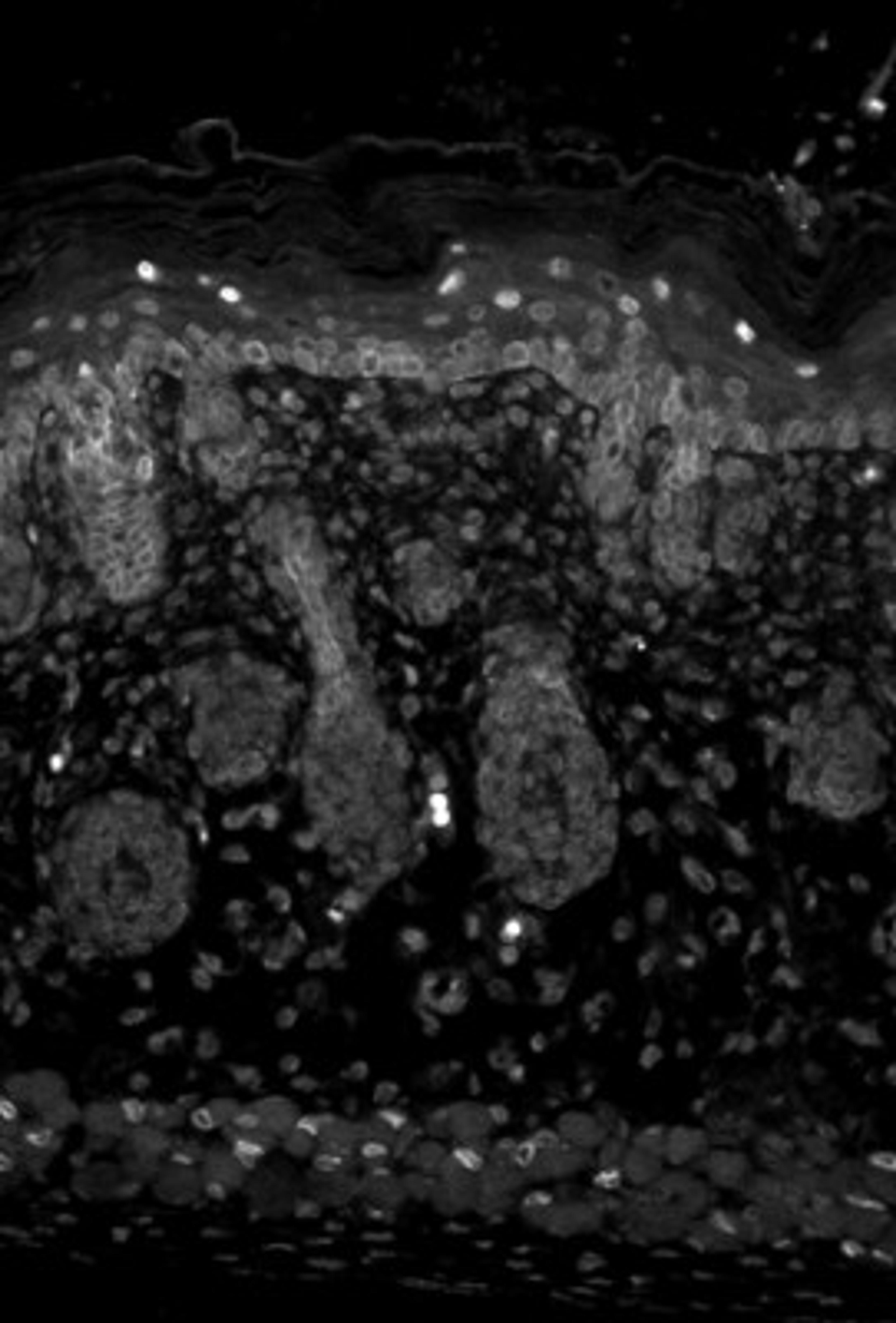 Immunohistochemistry-Paraffin: Kir2.1 Antibody (S112B-14) [NBP2-12900] - Mouse backskin sections. Courtesy of Dr. Turksen, Ottawa Hospital Research Institute, Canada.