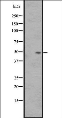 Western blot analysis of Fetal Kidney Lysate using SS3R antibody