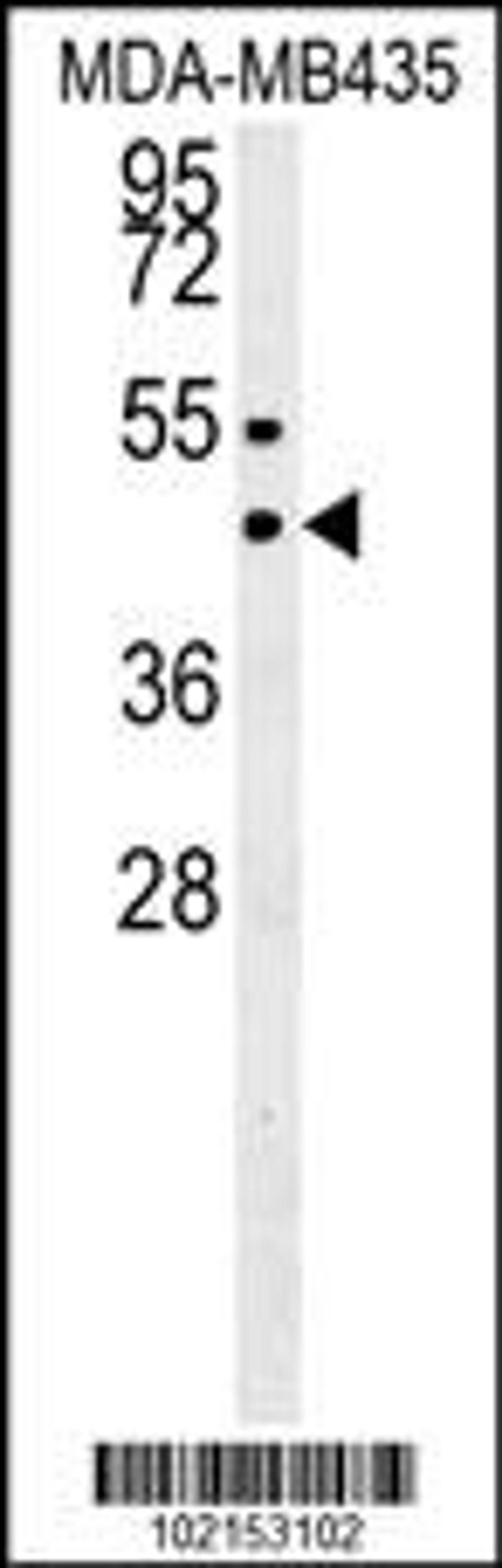 Western blot analysis in MDA-MB435 cell line lysates (35ug/lane). This demonstrates the SUV39H1 antibody detected the SUV39H1 protein (arrow).