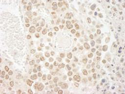 Detection of mouse DTL/CDT2 by immunohistochemistry.