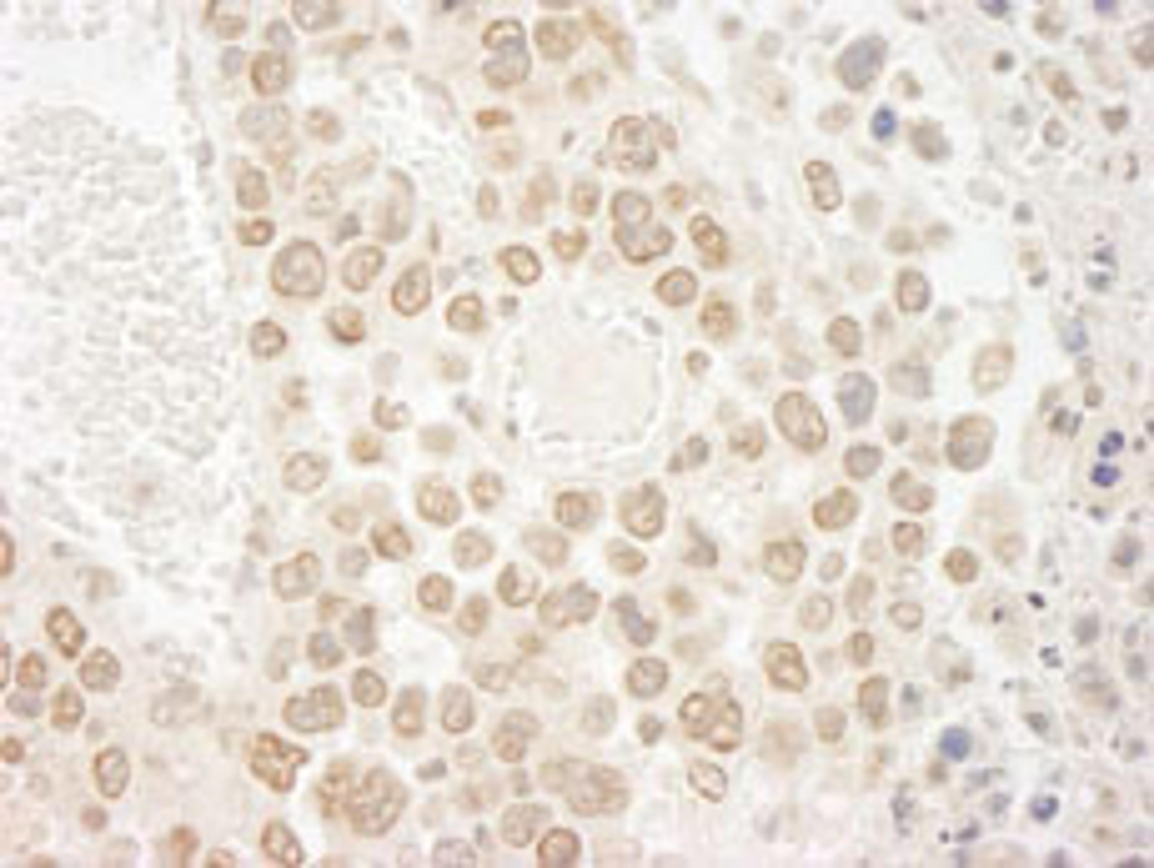 Detection of mouse DTL/CDT2 by immunohistochemistry.