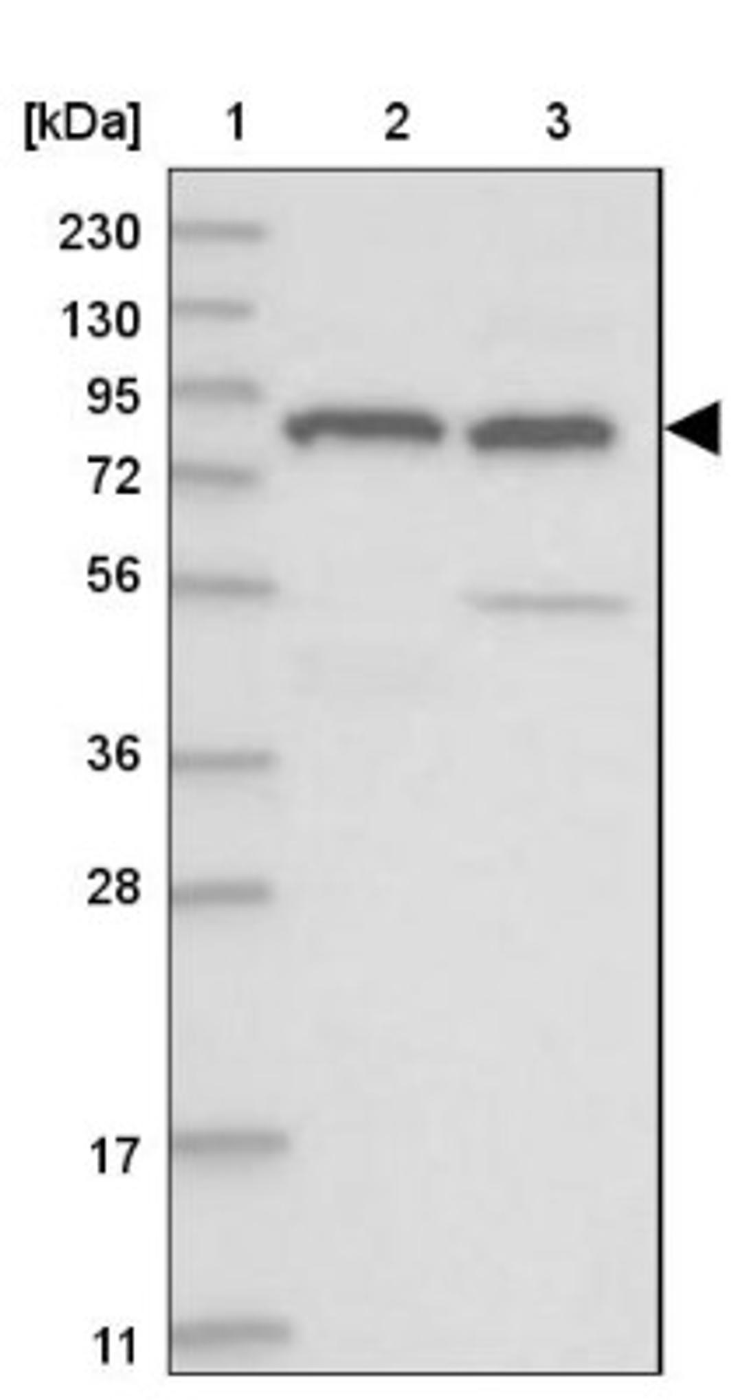 Western Blot: TDRD1 Antibody [NBP1-84349] - Lane 1: Marker [kDa] 230, 130, 95, 72, 56, 36, 28, 17, 11<br/>Lane 2: Human cell line RT-4<br/>Lane 3: Human cell line U-251MG sp