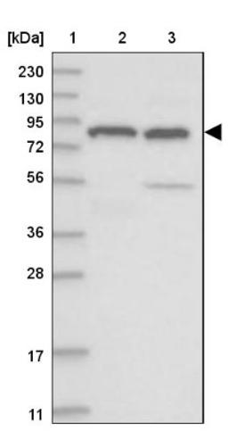 Western Blot: TDRD1 Antibody [NBP1-84349] - Lane 1: Marker [kDa] 230, 130, 95, 72, 56, 36, 28, 17, 11<br/>Lane 2: Human cell line RT-4<br/>Lane 3: Human cell line U-251MG sp