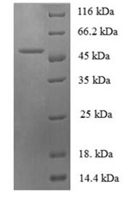 (Tris-Glycine gel) Discontinuous SDS-PAGE (reduced) with 5% enrichment gel and 15% separation gel.