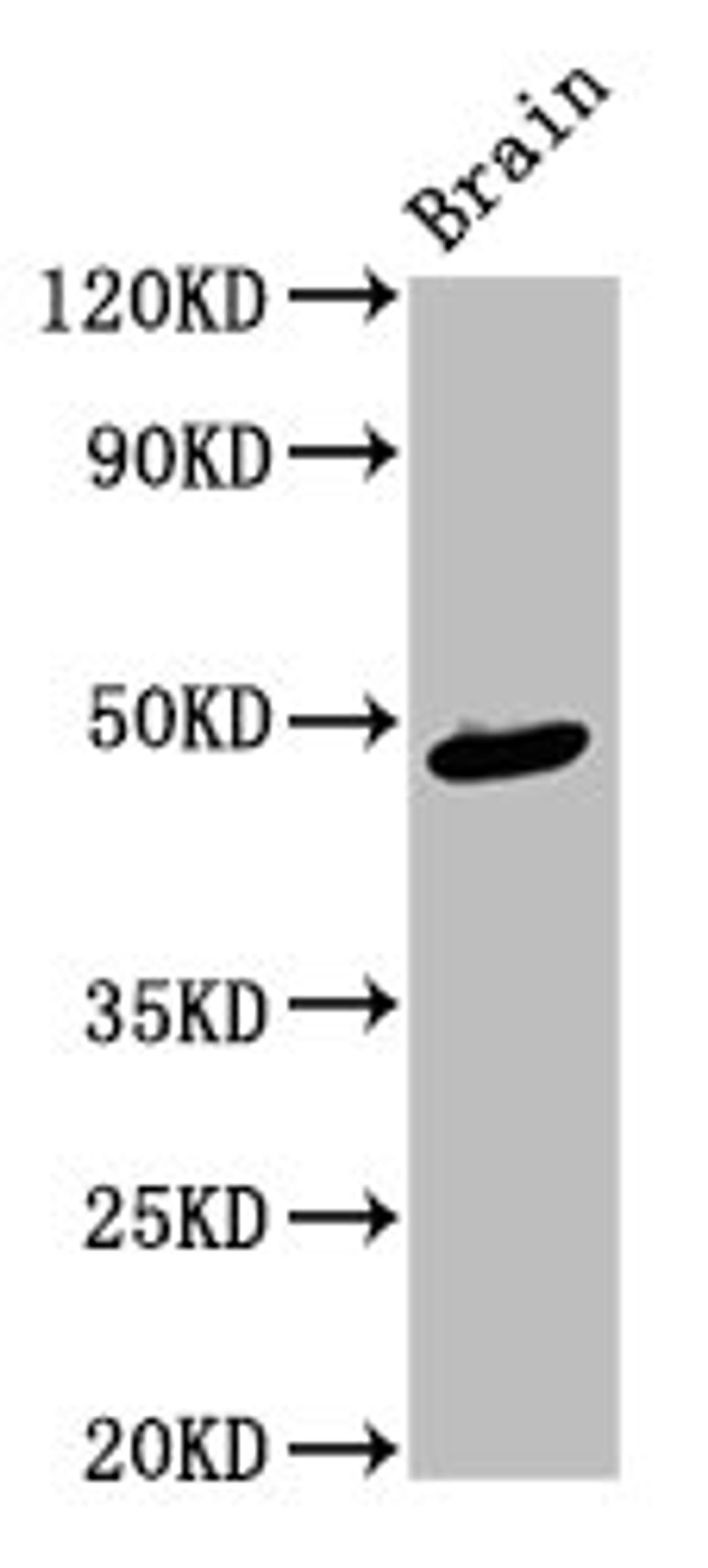 Western Blot. Positive WB detected in: Rat brain tissue. All lanes: AMBN antibody at 4ug/ml. Secondary. Goat polyclonal to rabbit IgG at 1/50000 dilution. Predicted band size: 49, 47 kDa. Observed band size: 49 kDa. 