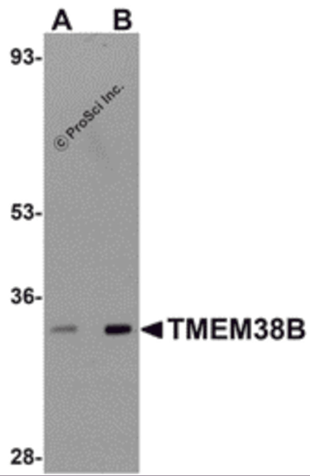 Western blot analysis of TMEM38B in rat thymus tissue lysate with TMEM38B antibody at (A) 1 and (B) 2 &#956;g/mL.